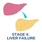 liver disease