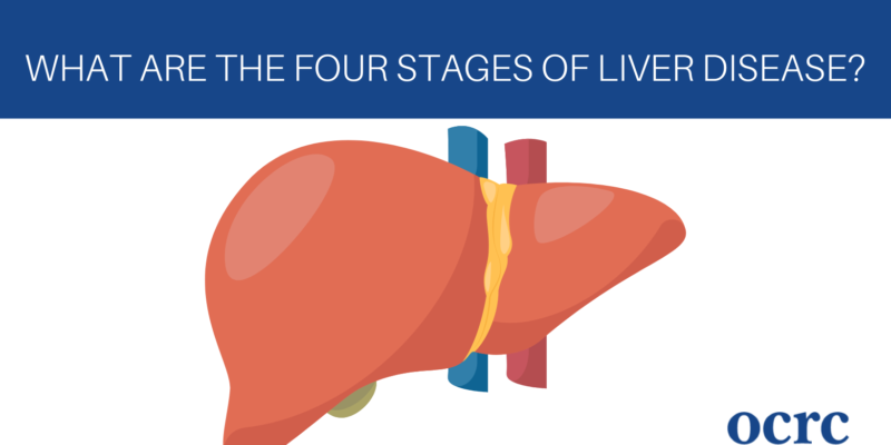 What are the Four Stages of Liver Disease?